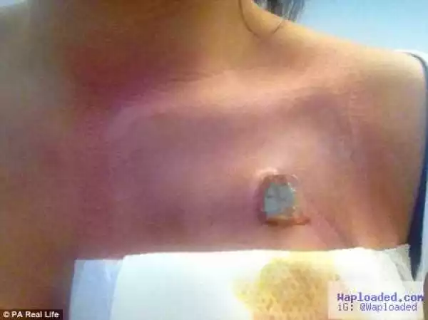 Woman Wakes to Discover a Gaping Hole Dug in her Chest...See the Shocking Reason (Photos)
